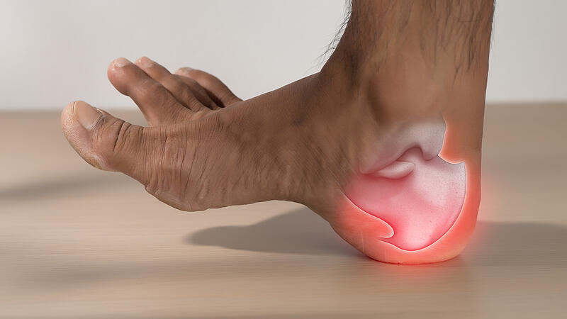 A man has heel pain due to plantar fasciitis